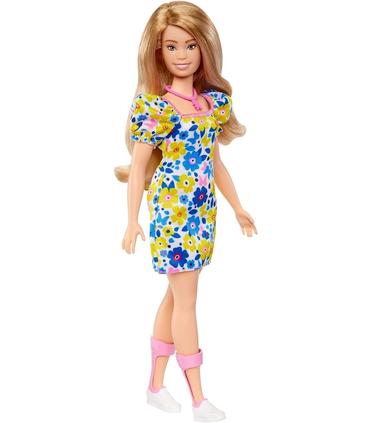 barbie-fashionista-sindrome-de-down